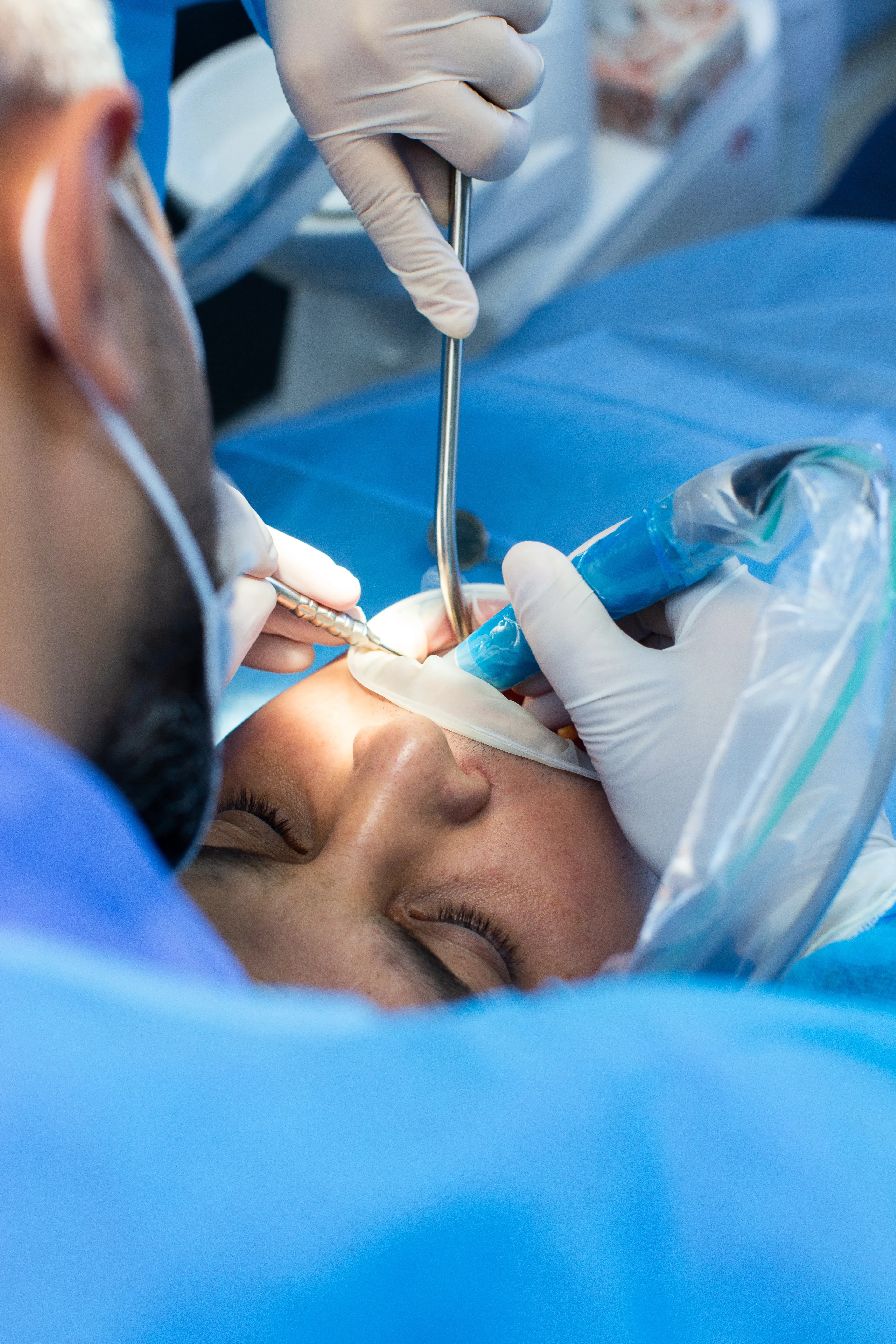What Is Dental Bonding?